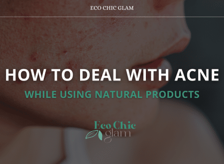 How to Deal with Acne While Using Natural Products