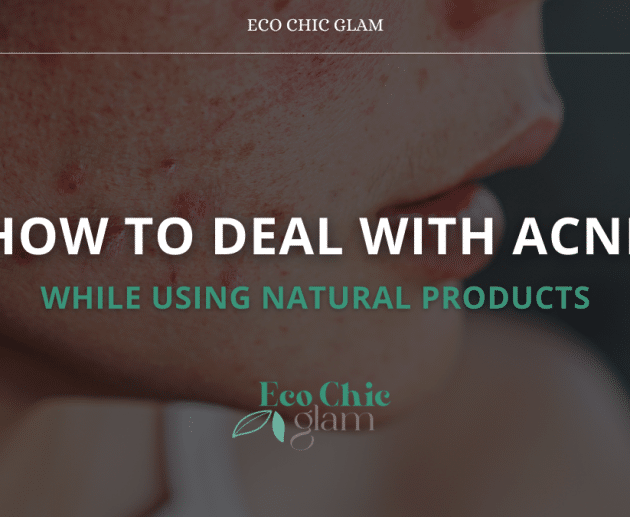 How to Deal with Acne While Using Natural Products